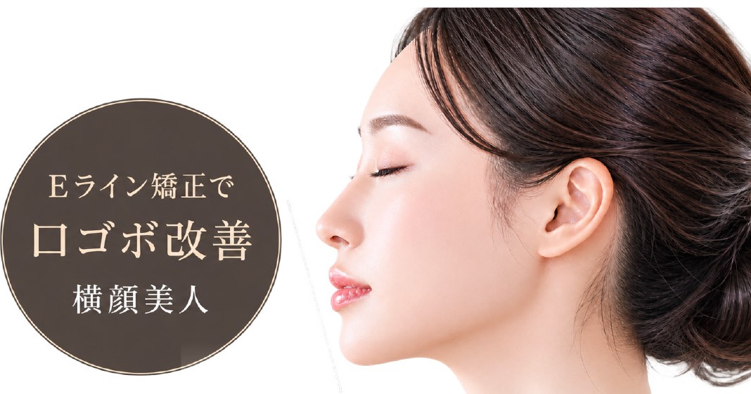 Eライン矯正でEライン改善